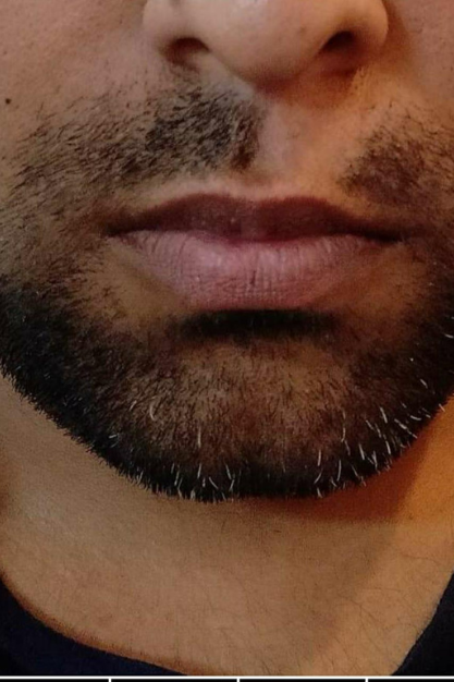 Before image