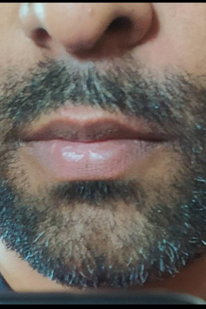 After image
