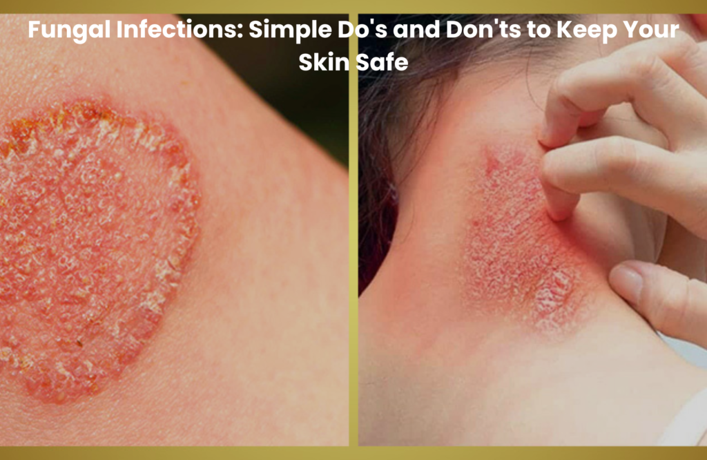 Close-up images of fungal skin infection on neck and body, showing red, itchy, and scaly patches of skin irritation